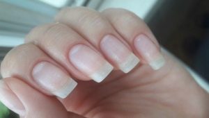 Cum să restabiliți unghiile după shellac?