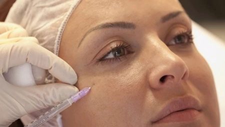 Mesotherapie van het gezicht: wat is het en hoe wordt het uitgevoerd?