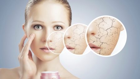 Die Feinheiten der trockenen Hautpflege