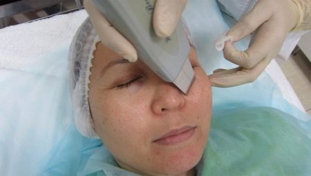 Pravidla pro ultrazvukové čištění obličeje