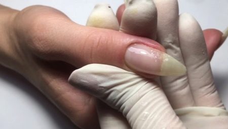 Cechy budowy złamanego paznokcia