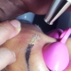 Тънкостите на процеса на лазерно премахване на татуировка на веждите