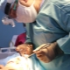 Endoskopinio veido pakėlimo procedūros ypatybės