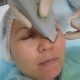 Regler for ultralyd ansiktsrensing