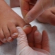 Les ongles des orteils grandissent: causes et méthodes de traitement