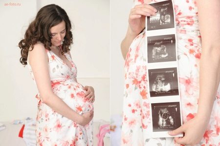 Kuva raskaana olevasta naisesta ultraäänellä
